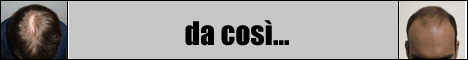 La soluzione al diradamento di capelli, in 20 secondi!