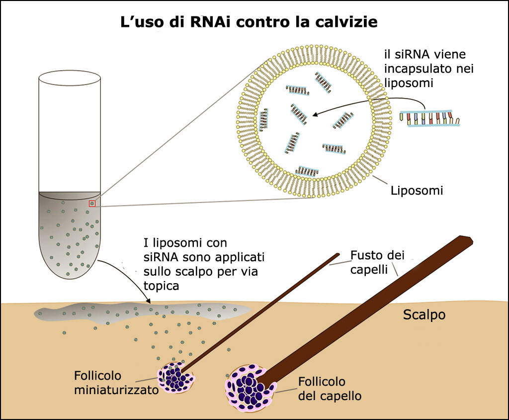 L'applicazione topica di un farmaco RNAi contro la calvizie