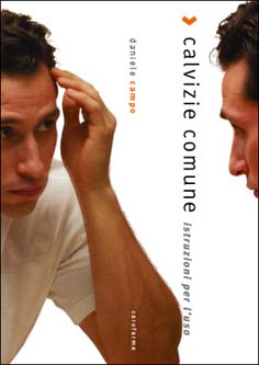 calvizie comune