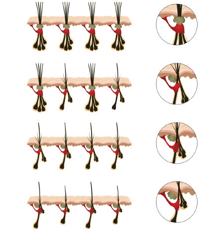 Aga e muscolo arrector pili