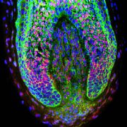 La foto originale dello studio che mostra un bulbo di follicolo con evidenziata la papilla dermica