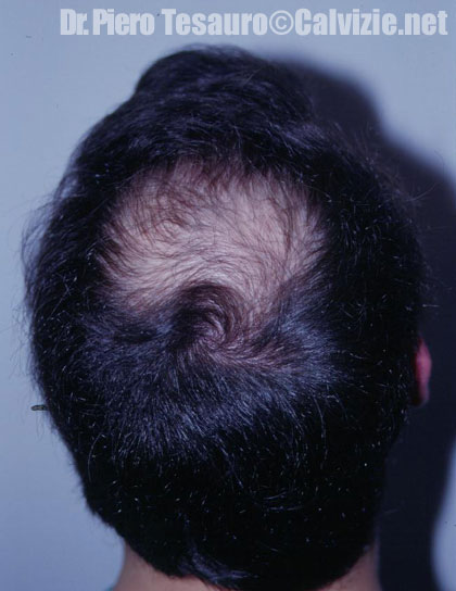 Ingrandisci la fotografia