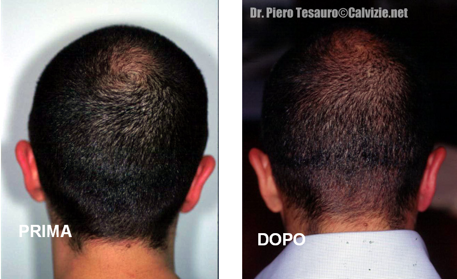 Ingrandisci la fotografia