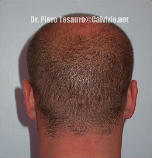 Ingrandisci la fotografia